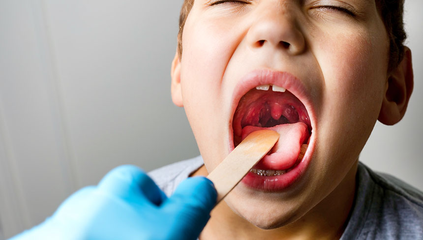 patient needing tonsillitis treatment in Irvine